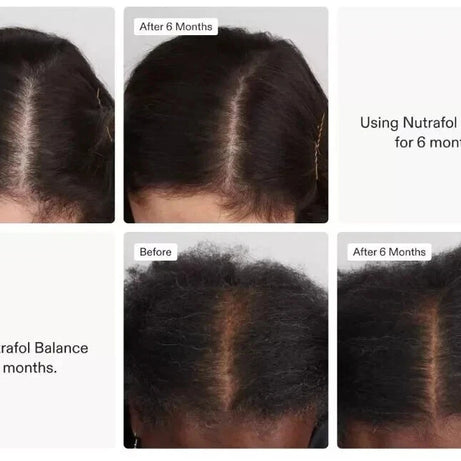 Nutrafol Women's Balance - Hair Growth Nutraceutical Supplement, 120 Capsules Uk