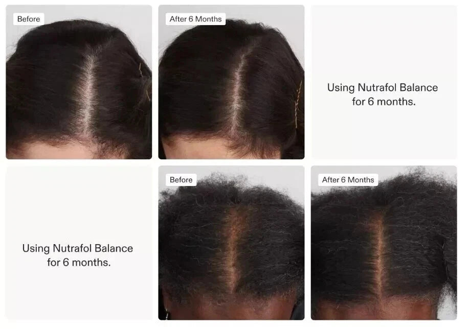 Nutrafol Women's Balance - Hair Growth Nutraceutical Supplement, 120 Capsules Uk